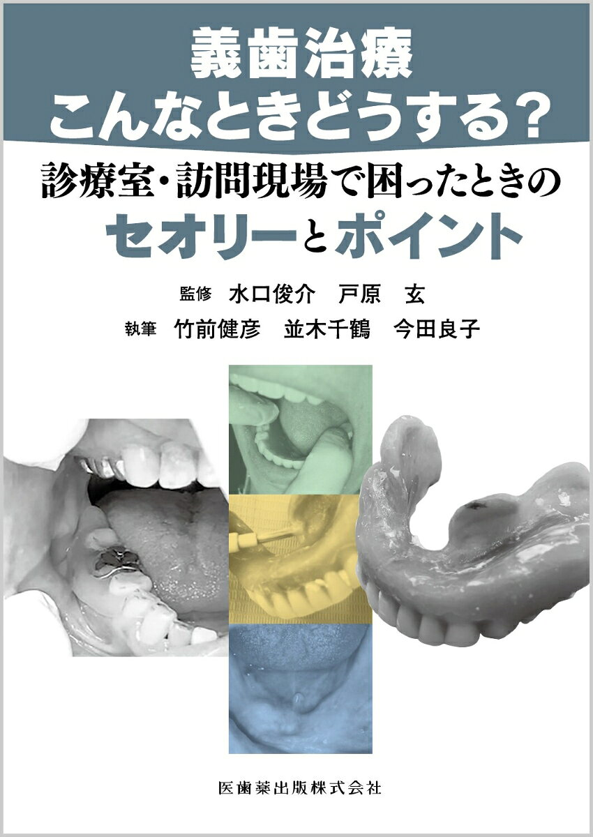 義歯治療こんなときどうする? : 診療室・訪問現場で困ったときのセオリーとポイント