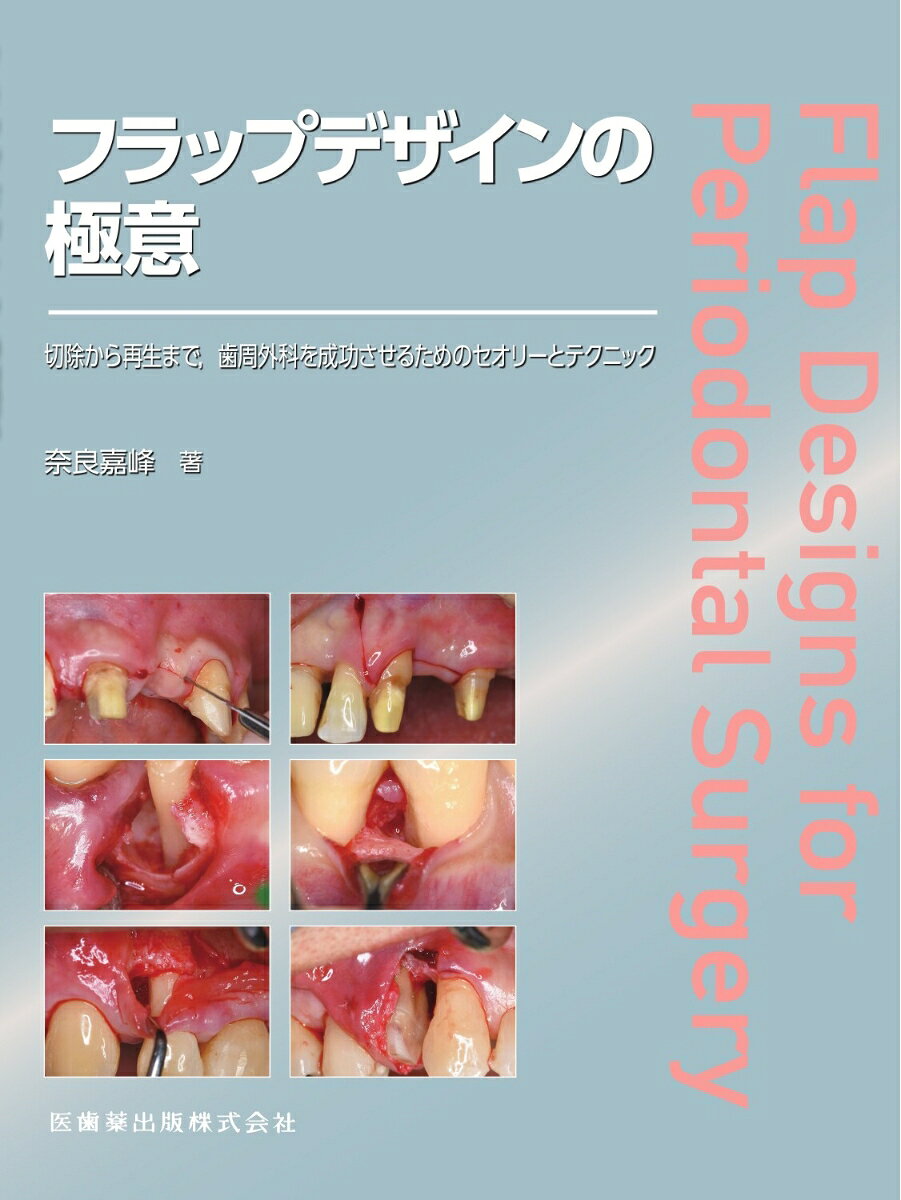 フラップデザインの極意 : 切除から再生まで，歯周外科を成功させるためのセオリーとテクニック