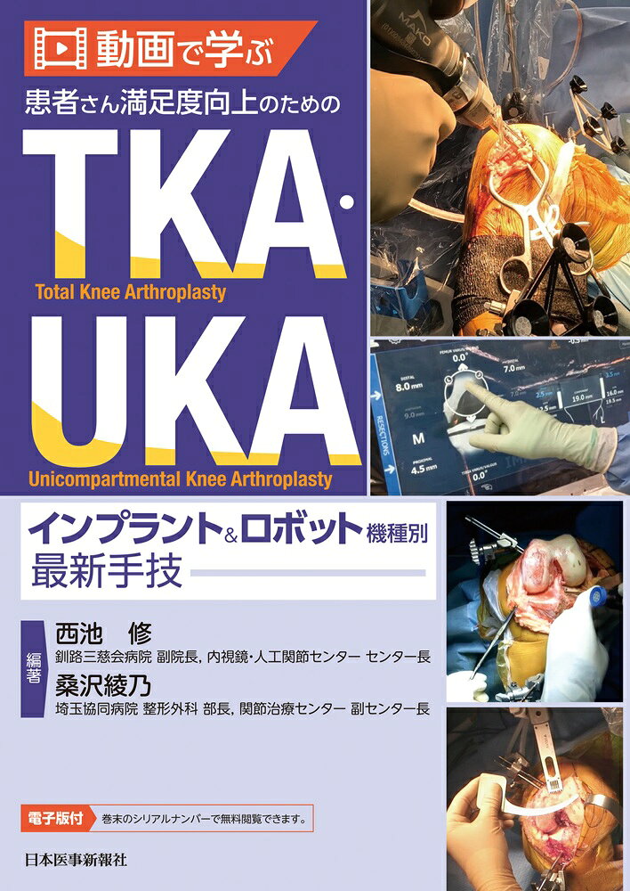 動画で学ぶ患者さん満足度向上のためのTKA・UKAインプラント&ロボット機種別最新手技 / Douga De Manabu Kanja San Manzokudo Koujou Notameno Tka uka Inpuranto & Robotto Kishubetsu Saishin Tewaza