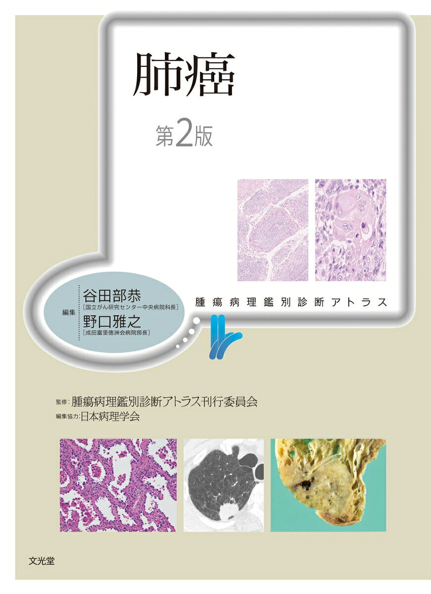 Haigan – Japanisches Buch | 肺癌